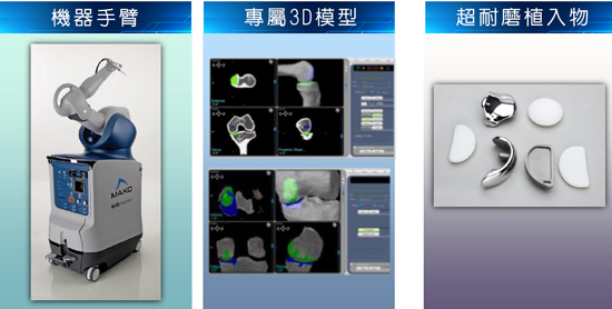 機器手臂、專屬3D模型、超耐磨植入物